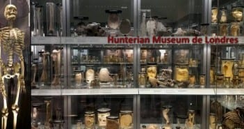 Hunterian Museum: El museo más escalofriante de Londres hunterian museo londres